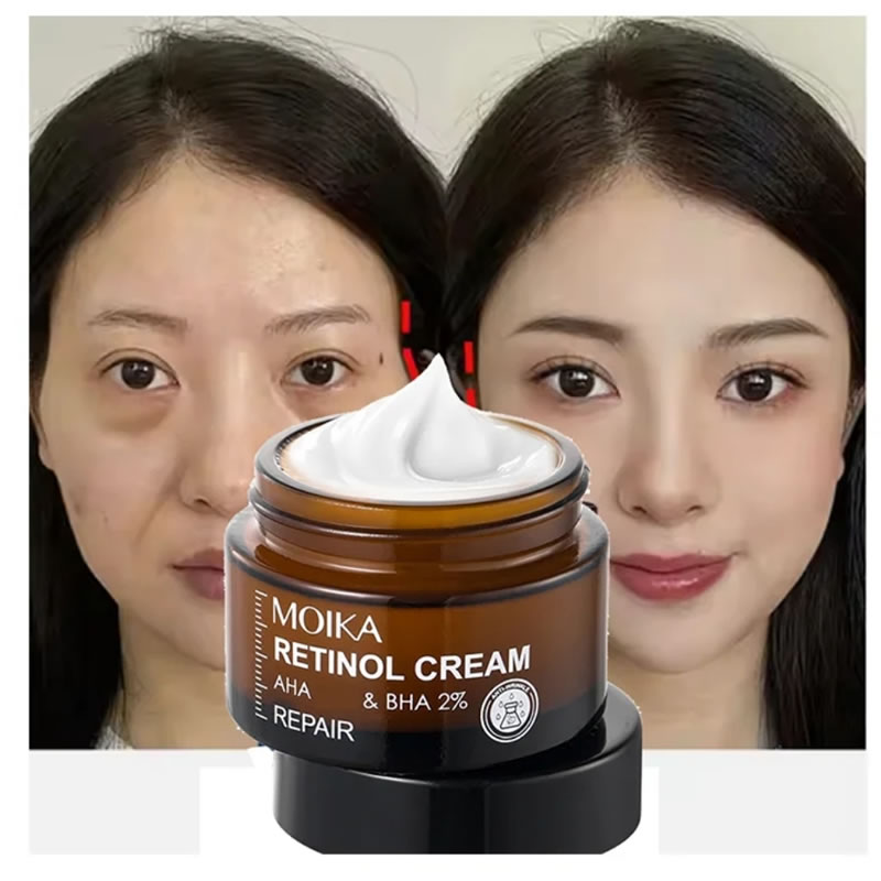 Moika Retino Cream