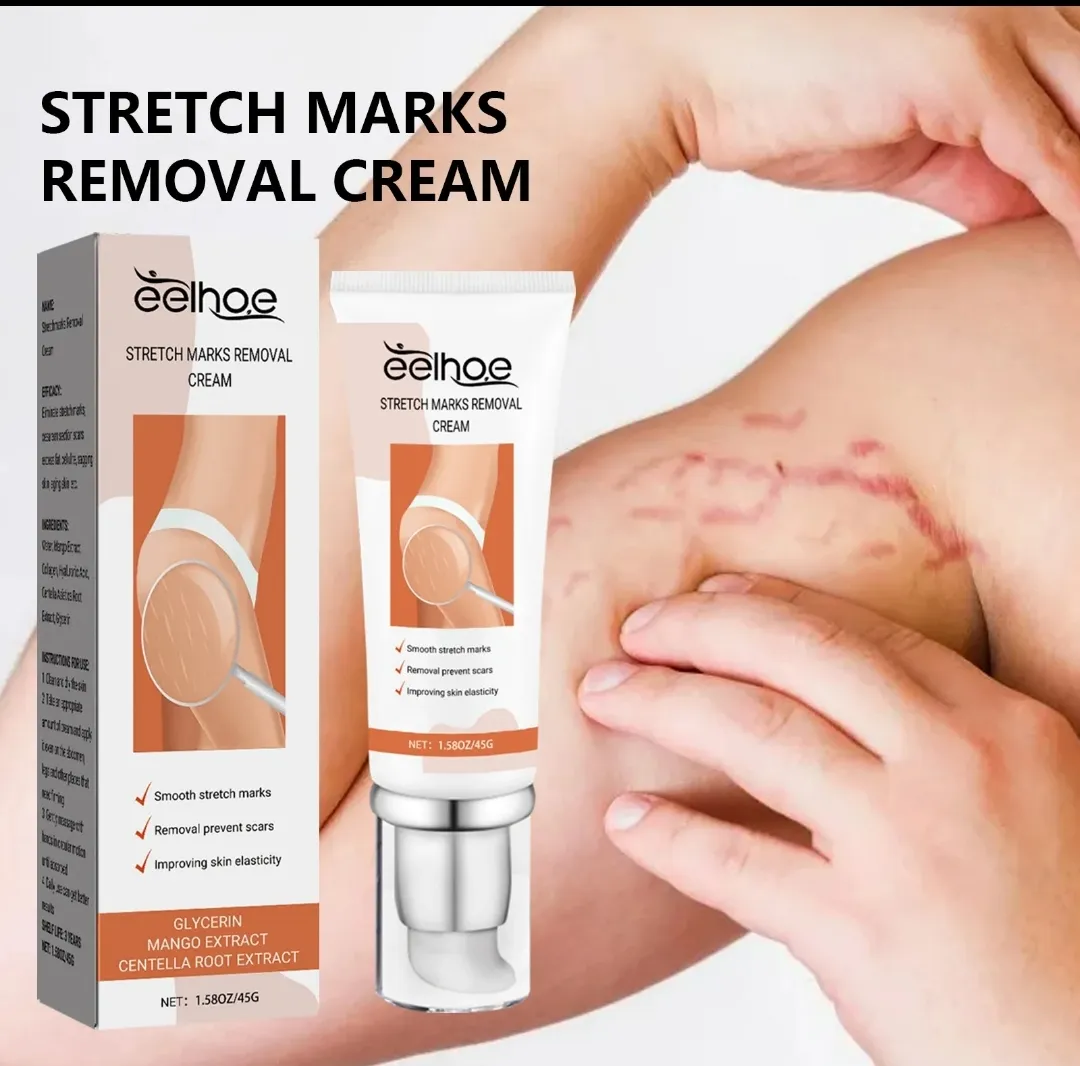 eelhoe Stretch Marks Removal Cream - Image 2