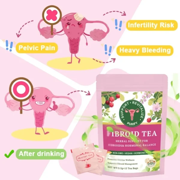 Fibroid Herbal Wellness Tea