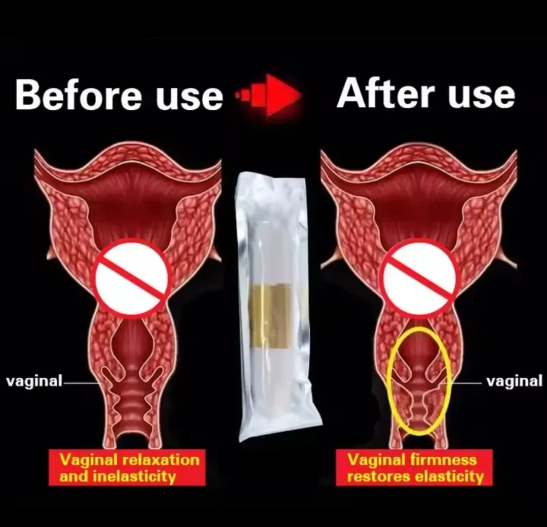 Varicose Vein Cream - Image 4